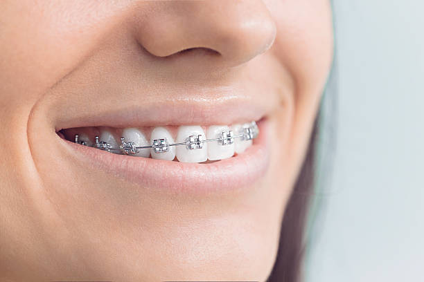 Dental Bonding in Blanchard, OK
